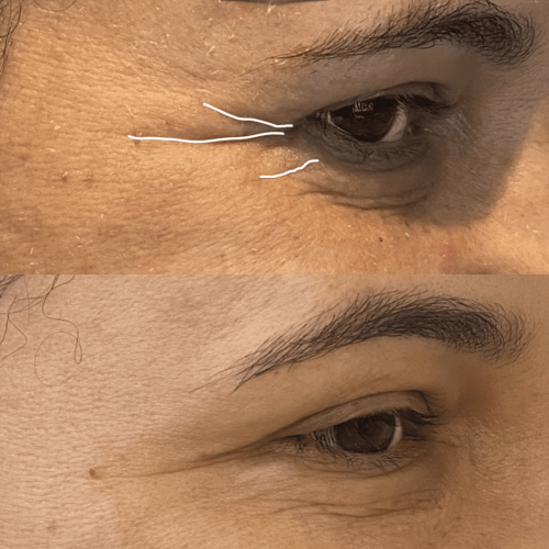 Antes e depois copiar 2